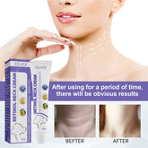 Retinol Neck Cream Neck Massage Desalting Neck Lines Nourishing