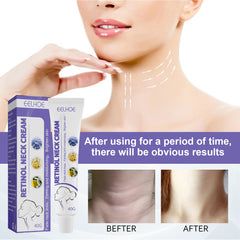 Retinol Neck Cream Neck Massage Desalting Neck Lines Nourishing