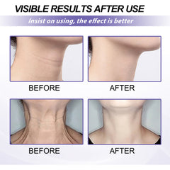 Retinol Neck Cream Neck Massage Desalting Neck Lines Nourishing